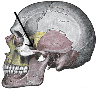 <span class="mw-page-title-main">Zygomatic arch</span> Cheek bone