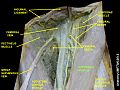 Sartorius muscle