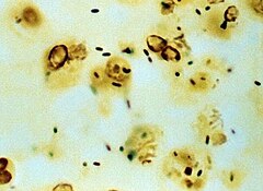 Legionella pneumophila, основний збудник легіонельозу, забарвлена сріблом, серед клітин респіраторного тракту