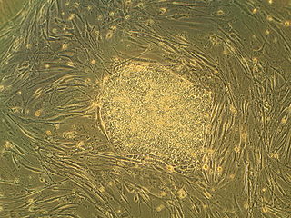 <span class="mw-page-title-main">Embryonic stem cell</span> Type of pluripotent blastocystic stem cell