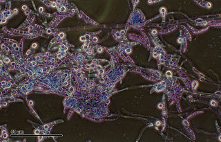 <i>Pythium</i> Genus of single-celled organisms