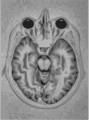 Axial Brain MRI, Vector