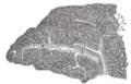 Transverse section saka limpa manungsa, nuduhaké distribusi artèri splenic lan cawang-cawangé.