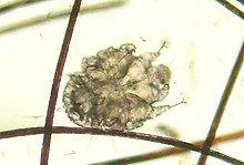 Sarcoptes scabiei Canine scabies mite.JPG