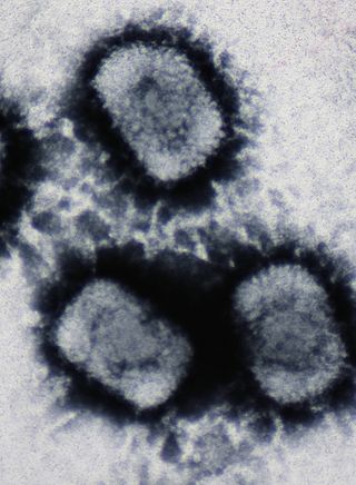 <span class="mw-page-title-main">Cowpox</span> Disease of humans and animals