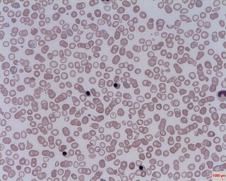 <span class="mw-page-title-main">Nucleated red blood cell</span> Red blood cell with a cell nucleus