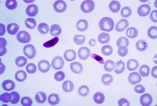 <i>Plasmodium falciparum</i> Protozoan species of malaria parasite