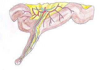 <span class="mw-page-title-main">Meckel's diverticulum</span> Medical condition