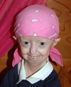 <span class="mw-page-title-main">Hayley Okines</span> British activist with progeria (1997–2015)