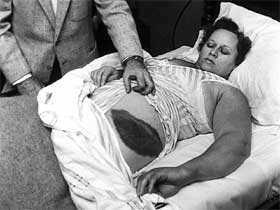 <span class="mw-page-title-main">Ann Elizabeth Fowler Hodges</span> American woman struck by a falling meteorite in 1954