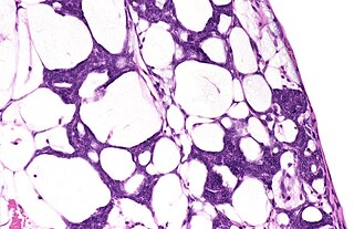 <span class="mw-page-title-main">Blastema</span> Mass of cells capable of enacting growth and regeneration