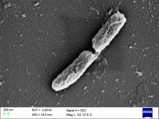 <i>Shigella flexneri</i> Species of bacterium