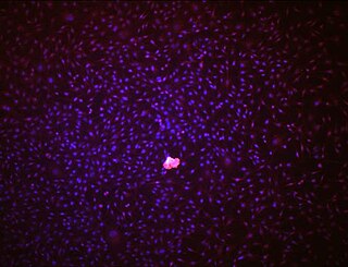 <span class="mw-page-title-main">Endothelial stem cell</span> Stem cell in bone marrow that gives rise to endothelial cells