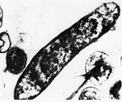 Thiobacillus ferrooxidans