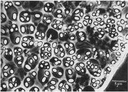 Anaerobacter polyendosporus під час споруляції, можна побачити кілька ендоспор у кожній клітині