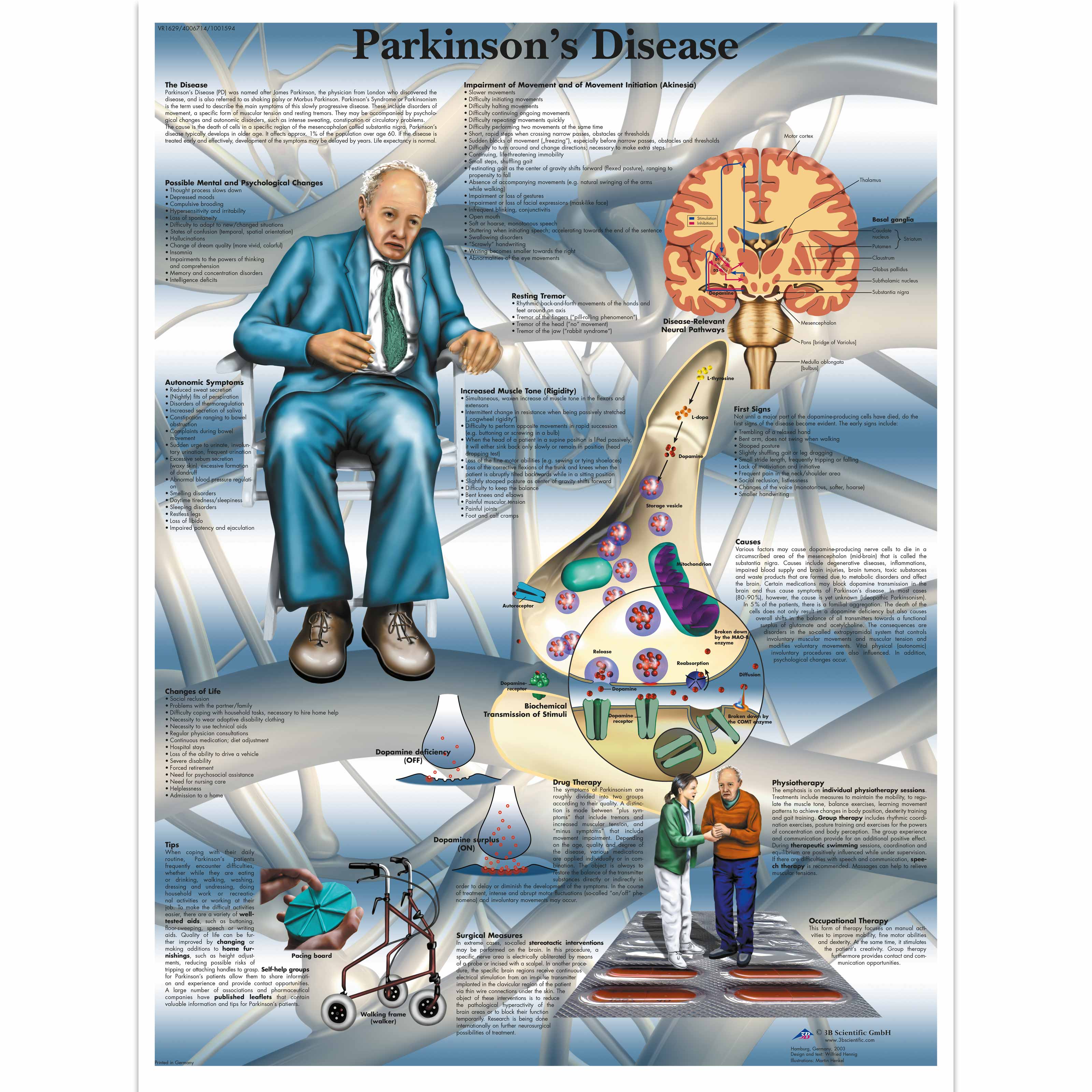 Parkinson's Disease Diagram