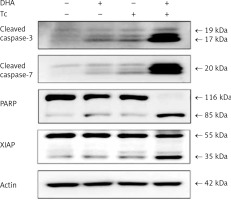 Induction of apoptosis in RL95-2 human endometrial cancer cells by ...