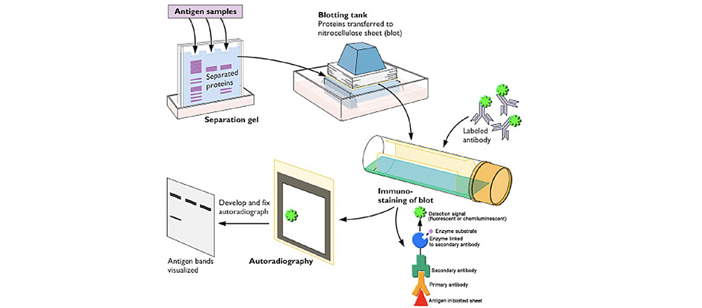 Western Blotting