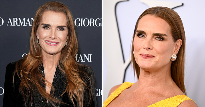 “Such An Invasion”: Brooke Shields Reveals Surgeon “Threw In A Little Bonus” During Labia Surgery