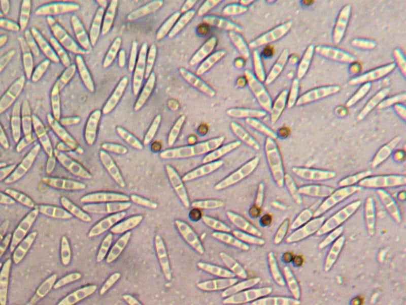 fusarium sp conidia