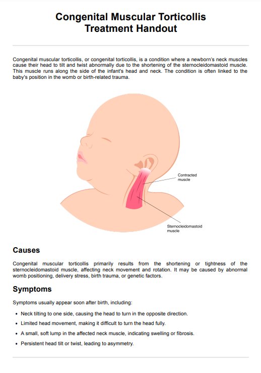 Congenital Muscular Torticollis Treatment Handout PDF Example