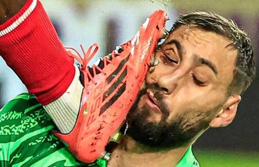 El portero del París Saint Germain (PSG) Gianluigi Donnarumma sufrió un traumatismo facial con múltiples heridas.