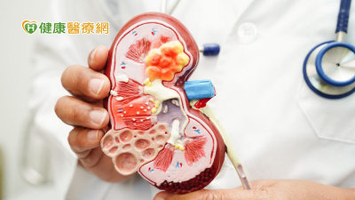 慢性腎病治療關鍵北榮、台大找到了！　抑制2蛋白質表現有望延緩洗腎