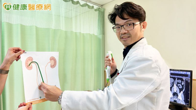 58歲男患結石　新式2.0軟式輸尿道內視鏡手術解決長期困擾