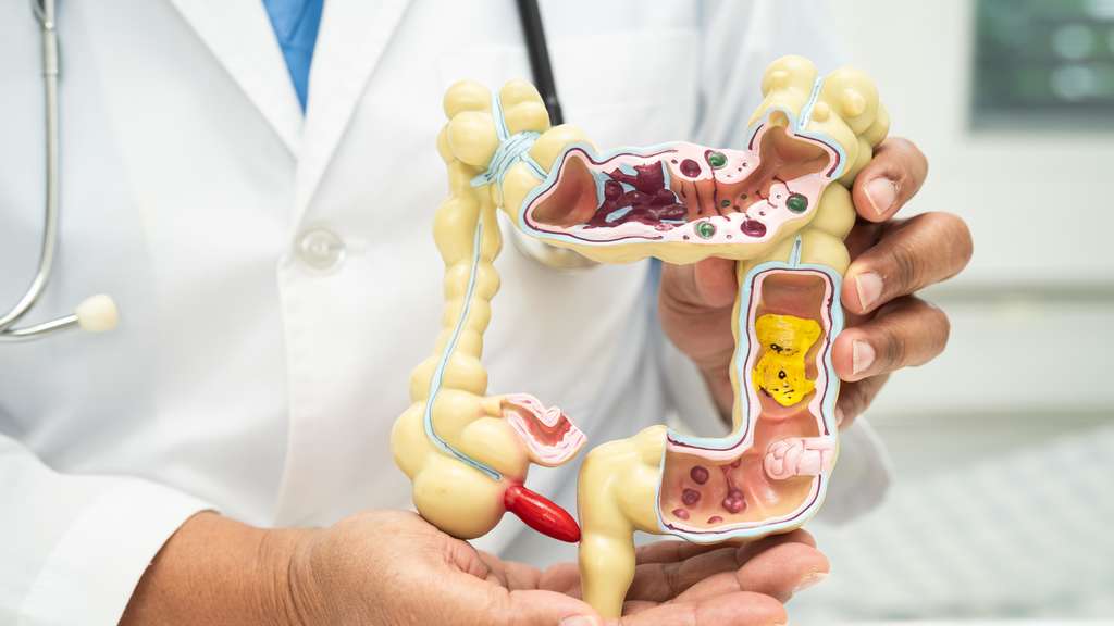 Darmgesundheit und Abnehmen: 8 Lebensmittel besser meiden