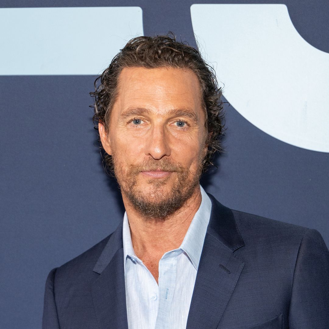 Matthew McConaughey shows off his impressive bee sting