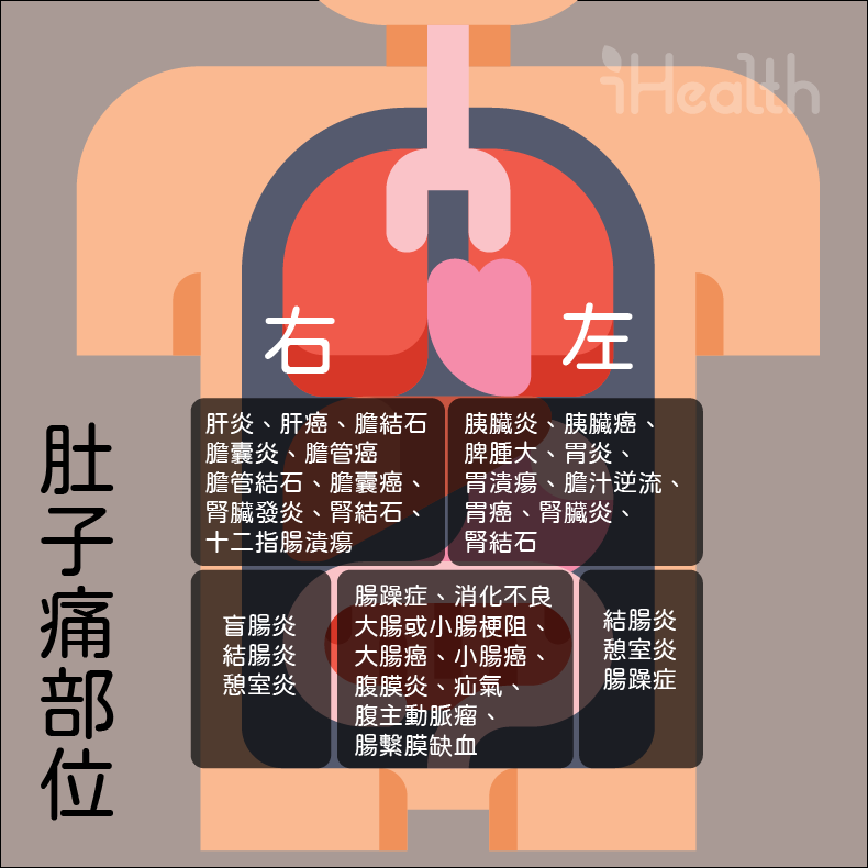 腹部的剖面圖，劃分出5個區塊，分別寫上該部位痛的可能疾病