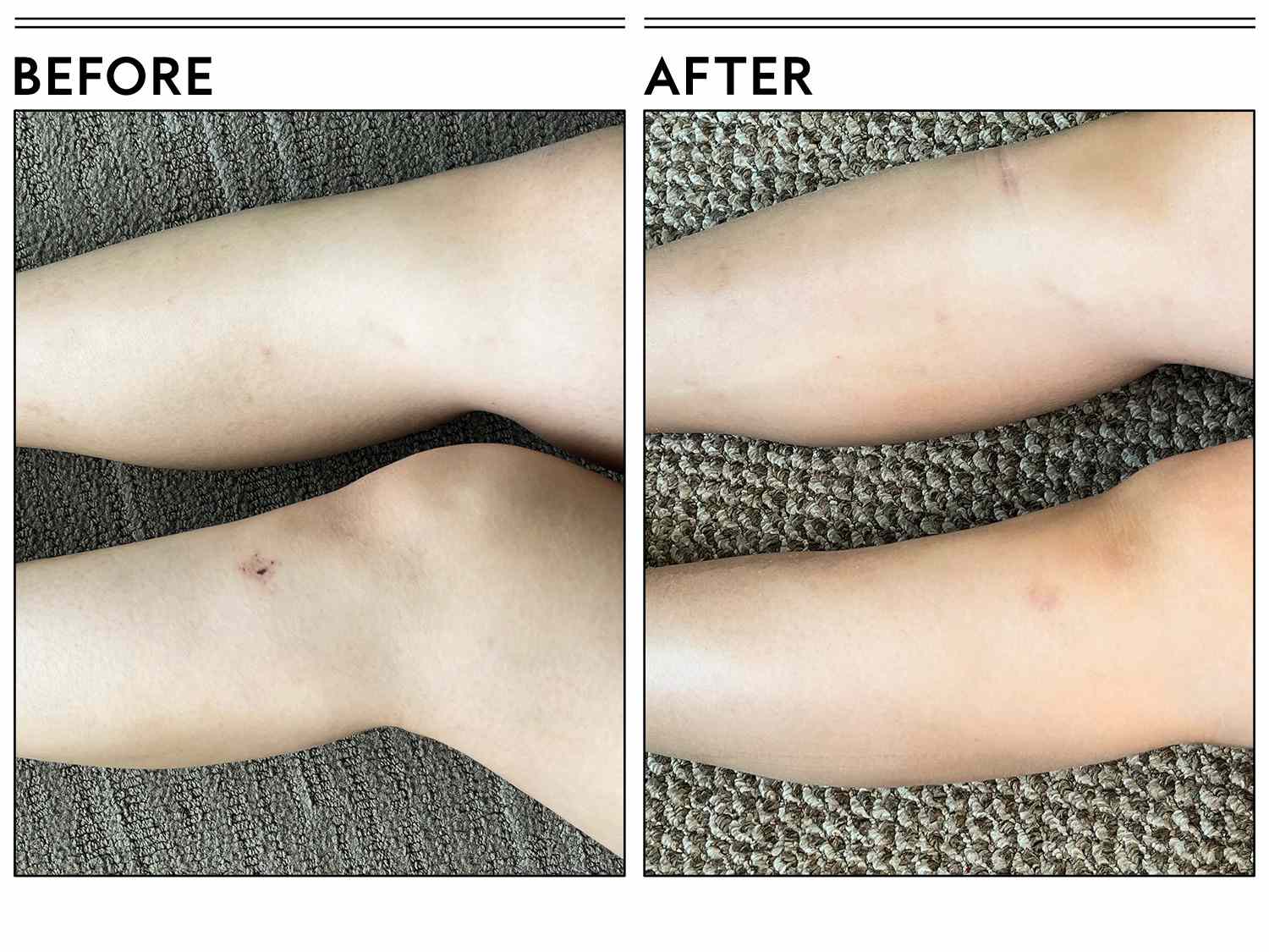 A before and after photo showing the effects of Elemis Skin Nourishing Shower Cream