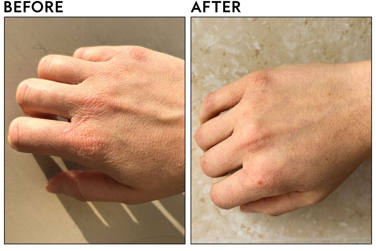 Eczema Honey Soothing Body Wash Before And After Application To Persons Hand