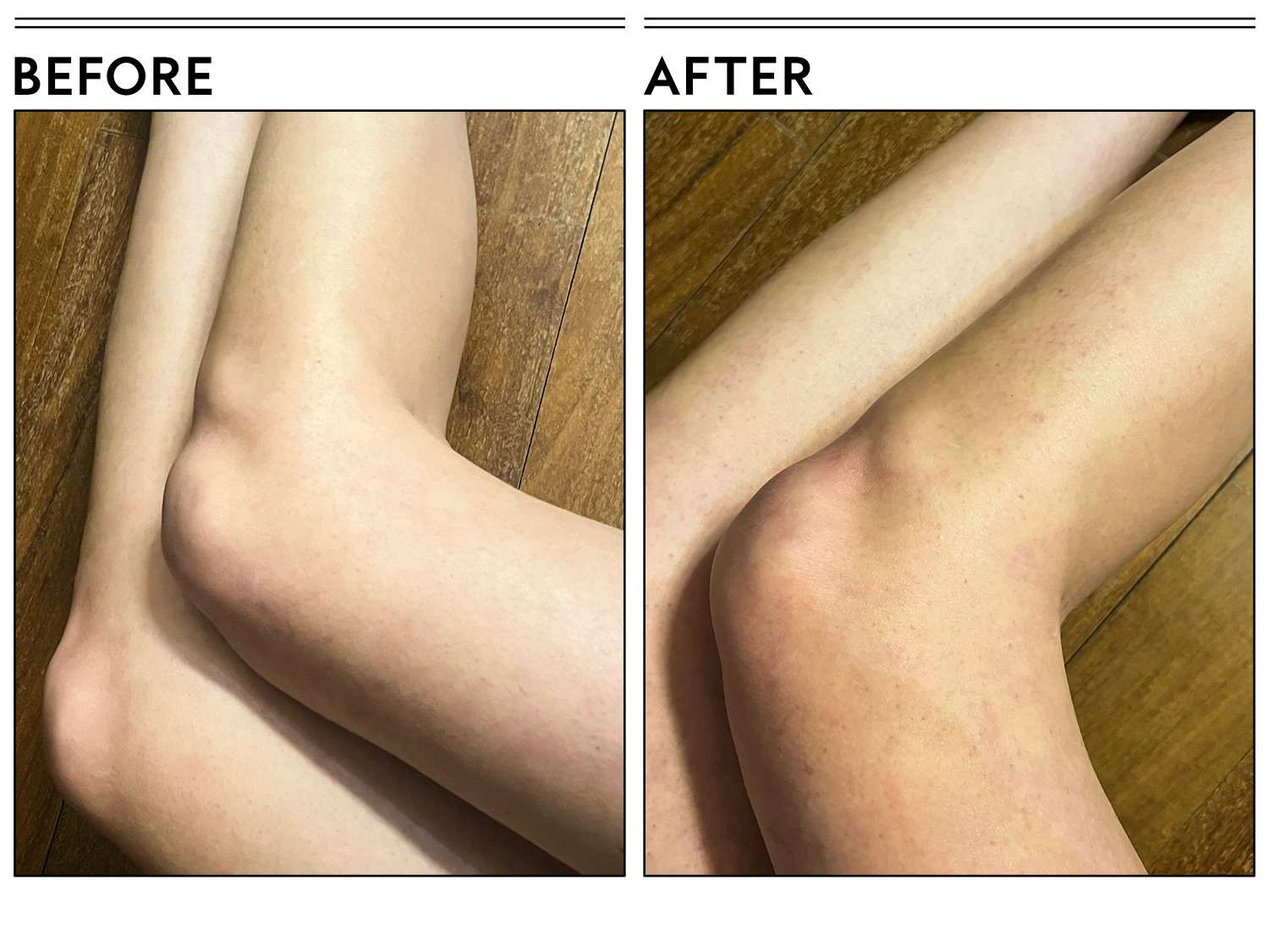 A before and after photo showing the effects of using Cetaphil Moisturizing Relief Body Wash on a person's legs