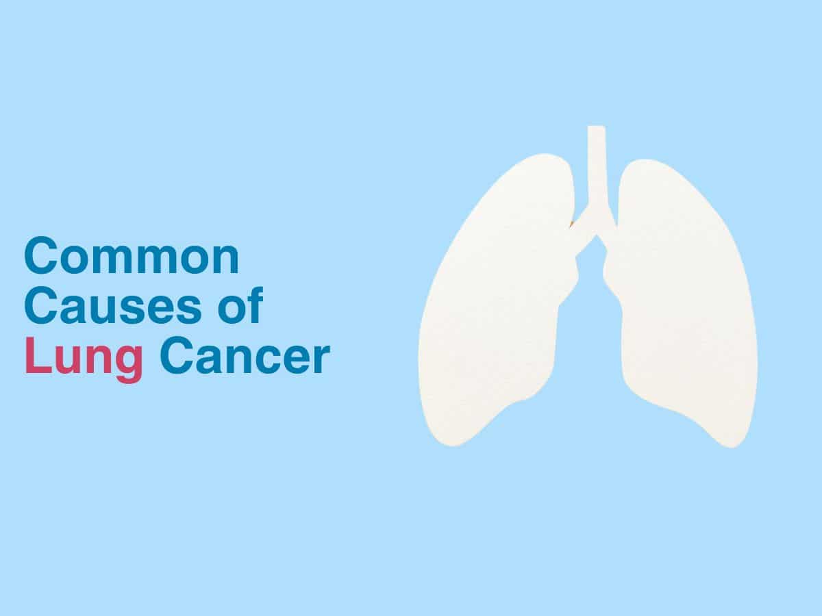 Common Causes of Lung Cancer - Multispeciality Hospital