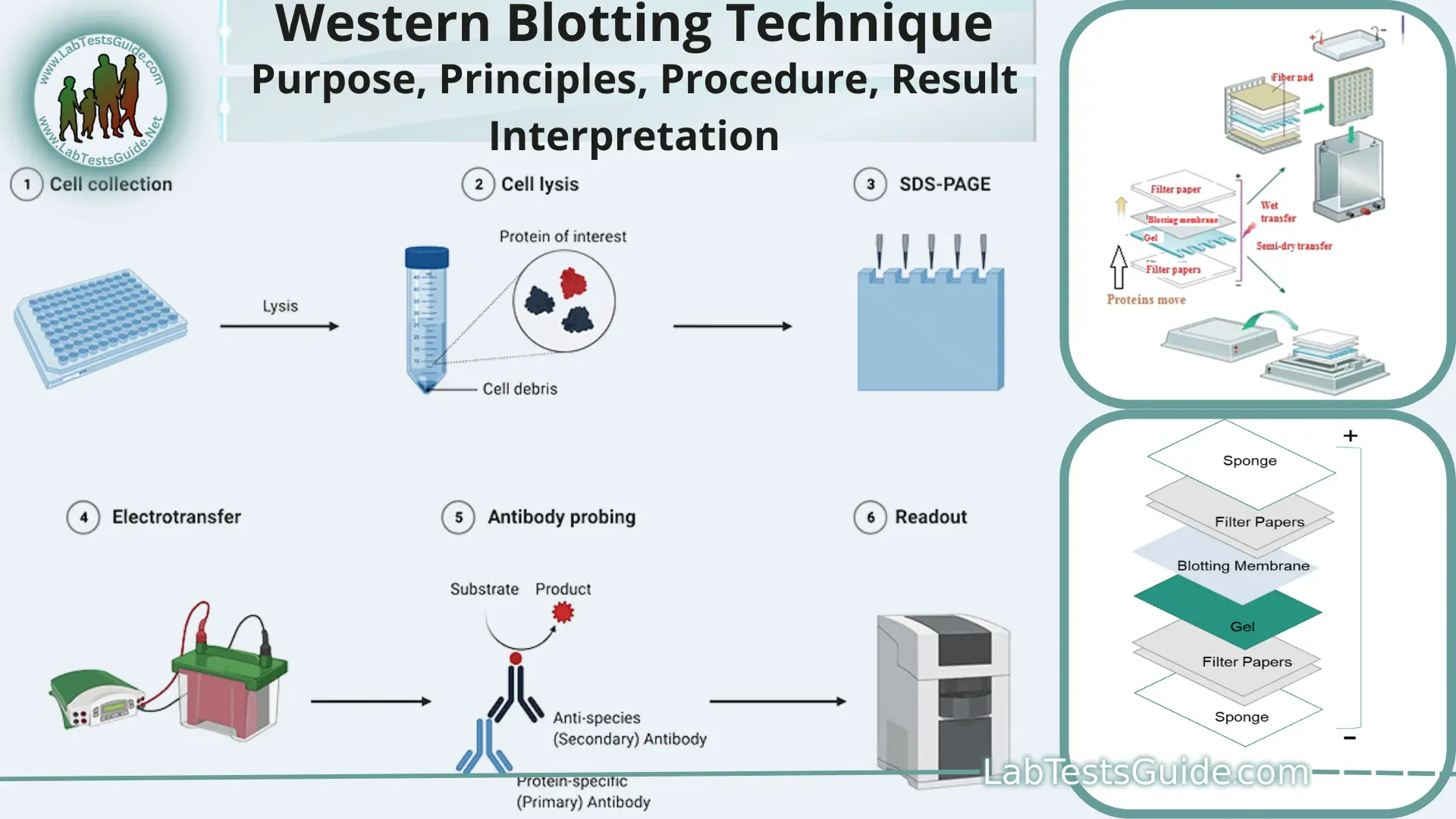 Western Blotting (Immunoblotting) | Lab Tests Guide