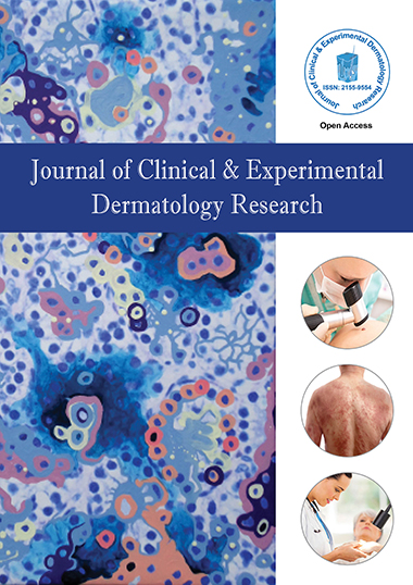 Journal of Clinical & Experimental Dermatology Research