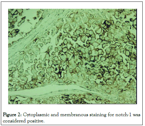 jcedr-Cytoplasmic