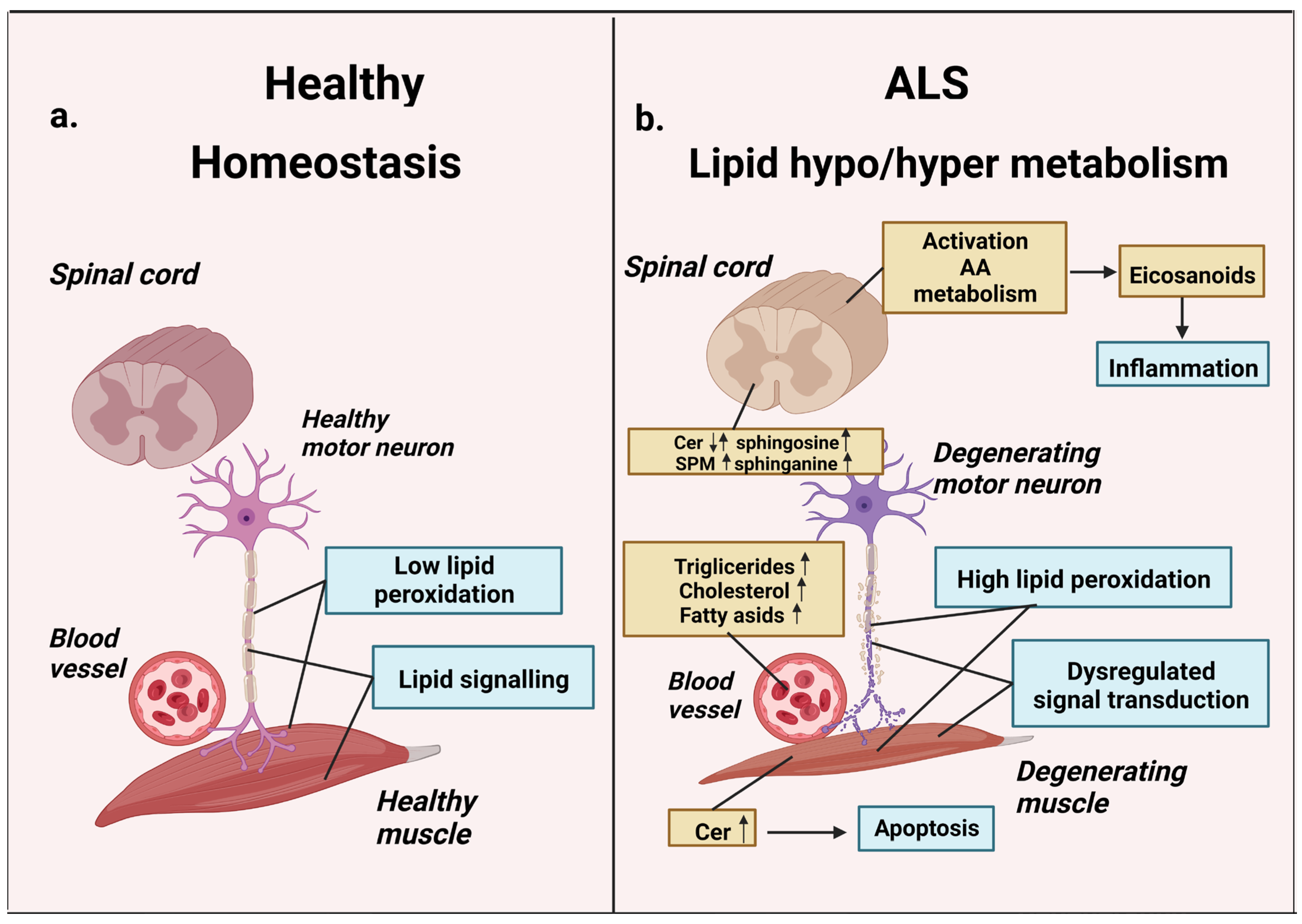 Life | Free Full-Text | Involvement of Lipids in the Pathogenesis of ...