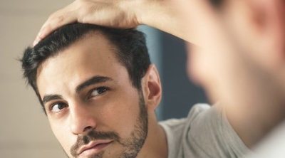 Alopecia: causas, síntomas, tipos y tratamiento