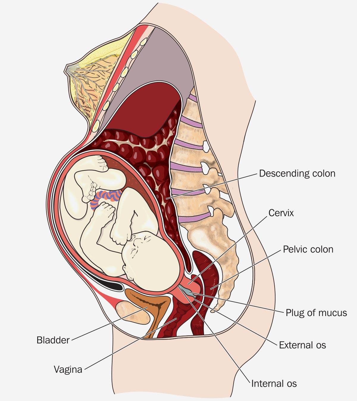 Uterine Cervical Prolapse During Pregnancy