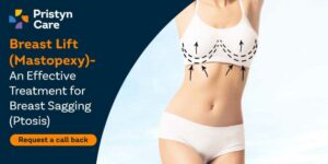 breast lift surgery for sagging breasts