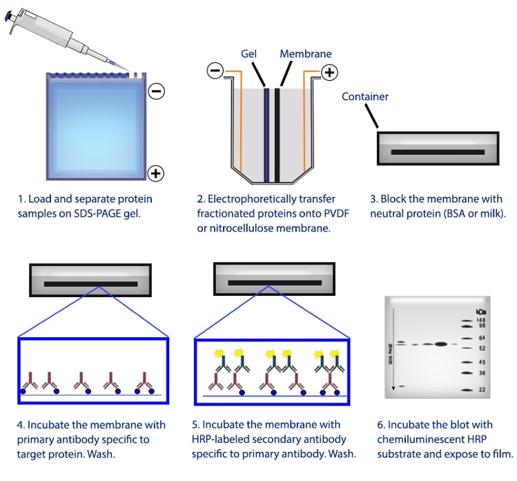 Western Blot Sds Page | Sexiz Pix