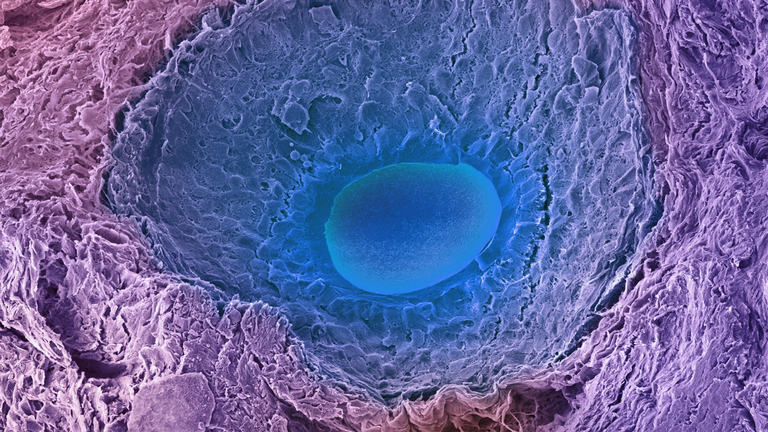 A colored scanning electron micrograph of a developing egg in an ovary follicle. The developing egg (oocyte) is a wide, flat oval sitting on a field of follicular cells.