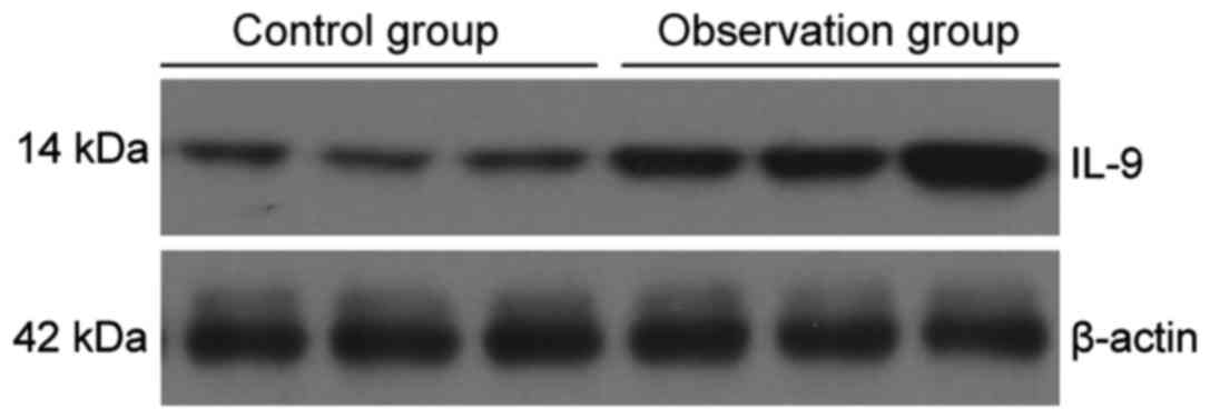 Analysis of the levels of Th9 cells and cytokines in the peripheral ...