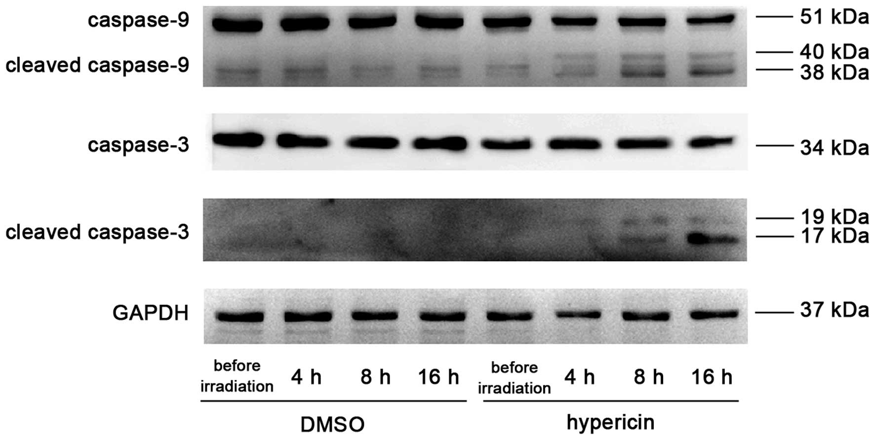 Hypericin-mediated photodynamic therapy induces apoptosis in K562 human ...