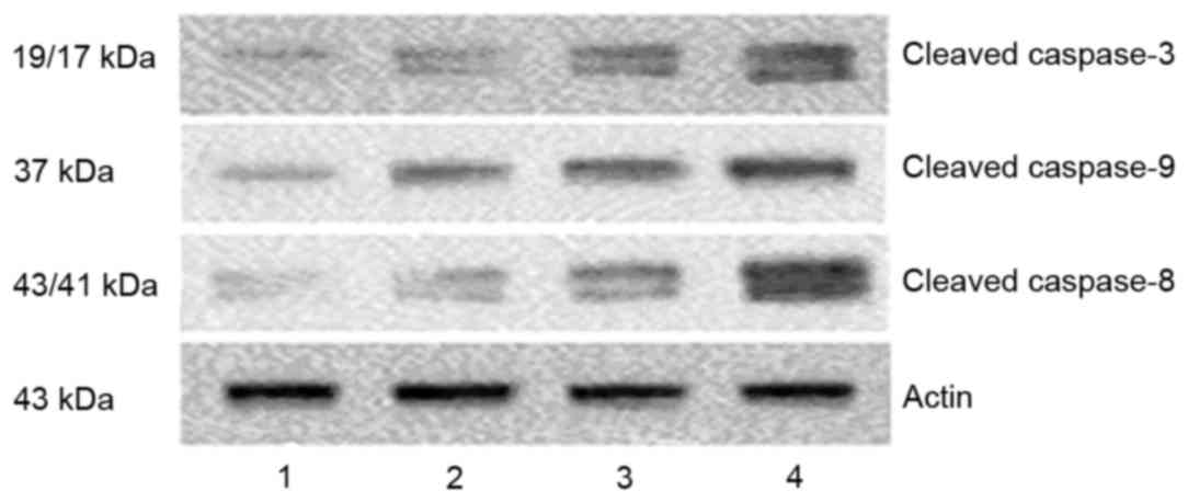 Apoptosis is induced by docosahexaenoic acid in breast cancer cells via ...