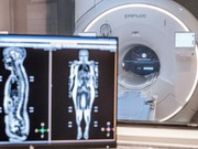 This photo provided by Prenuvo in July 2024 shows an MRI scanner. Magnetic resonance imaging uses magnetic fields to produce detailed images of organs, bones and other structures inside the body. Unlike many other types of scans, MRIs don't use radiation. (Prenuvo via AP)