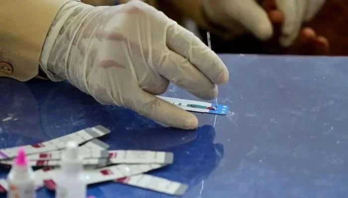 In this image taken on May 8, 2019, a doctor examines the blood sample from a patient for a HIV test at a public hospital. — AFP