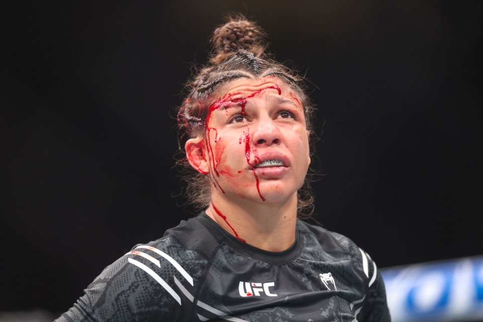 Mayra Bueno Silva suffered a sickening eye injury at UFC 303